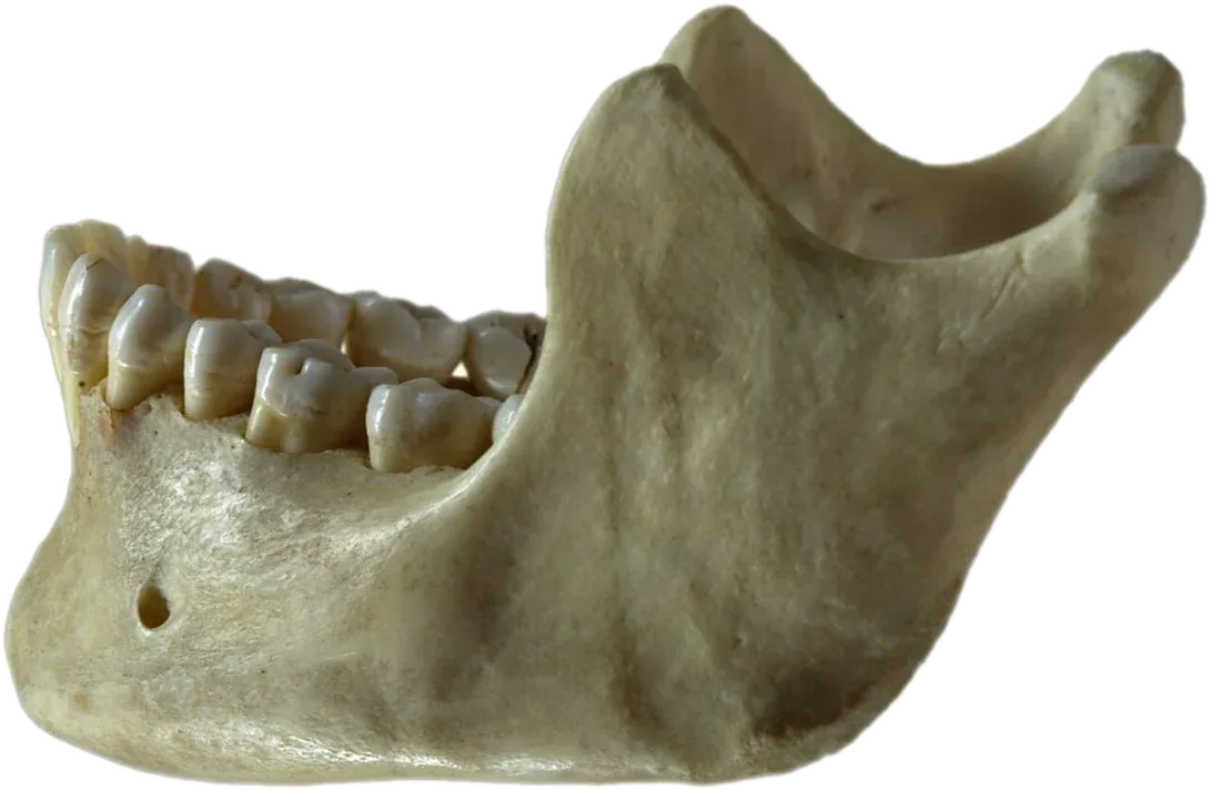 Mandíbula humana real vista de lado, con sus dientes y el agujero mentoniano